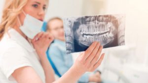 Is Wisdom Tooth Removal Always Necessary?
